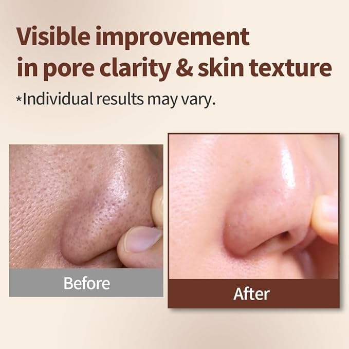 1.618 Korean Clay Mask with Bentonite & Kaolin ??Blackhead Remover - image 3